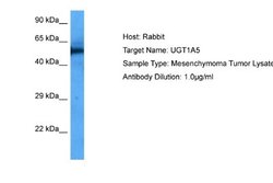 UGT1A5 Rabbit anti-Human, Polyclonal, Novus Biologicals 0.1ml; Unconjugated:Antibodies,